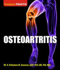 OSTEOARTRITIS